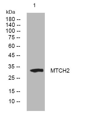 Anti-MTCH2 antibody (59-109 aa) (STJ193838) – Figure 1 of 1