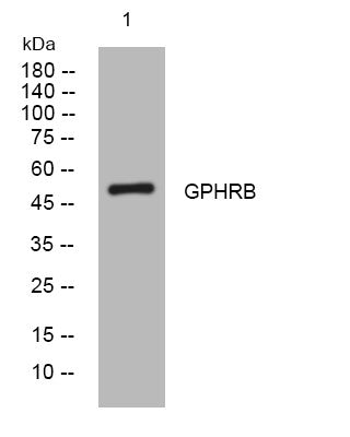 Anti-GPR89B antibody (270-320 aa) (STJ193845) – Figure 1 of 1