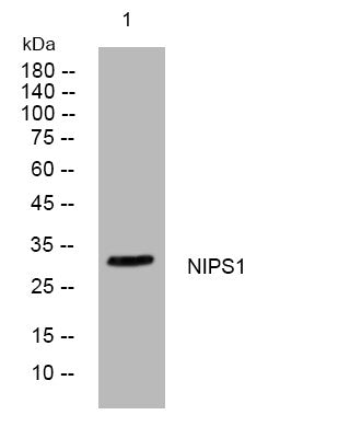 Anti-NIPSNAP1 antibody (183-233 aa) (STJ193851) – Figure 1 of 1