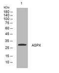 Anti-ACRV1 antibody (180-230 aa) (STJ193861) – Figure 1 of 1