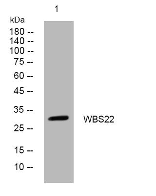 Anti-BUD23 antibody (144-194 aa) (STJ193867) – Figure 1 of 1