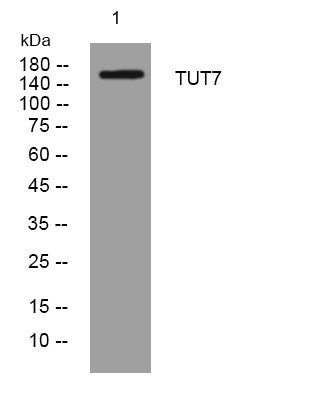 Anti-TUT7 antibody (3-53 aa) (STJ193886) – Figure 1 of 1