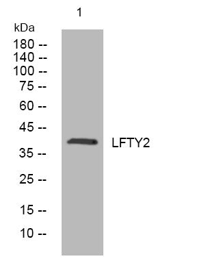 Anti-LEFTY2 antibody (205-255 aa) (STJ193923) – Figure 1 of 1