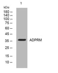 Anti-ADPRM antibody (225-275 aa) (STJ193926) – Figure 1 of 1