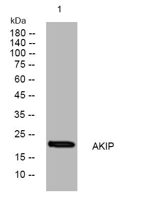 Anti-AURKAIP1 antibody (10-60 aa) (STJ193929) – Figure 1 of 1