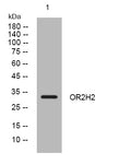 Anti-OR2H2 antibody (240-290 aa) (STJ193932) – Figure 1 of 1