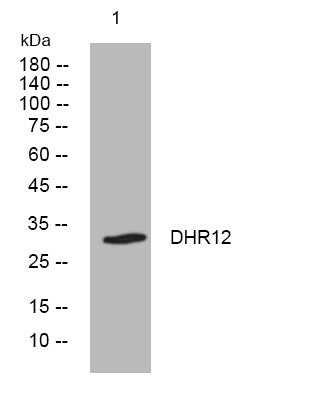 Anti-DHRS12 antibody (83-133 aa) (STJ193939) – Figure 1 of 1