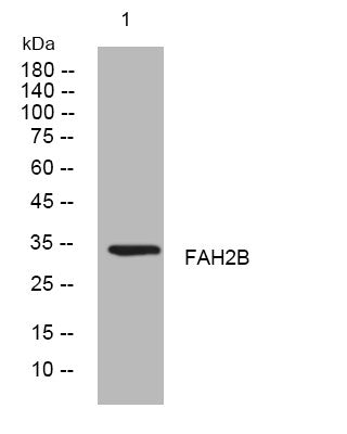Anti-FAHD2B antibody (156-206 aa) (STJ193951) – Figure 1 of 1