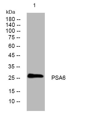 Anti-PSMA6 antibody (70-120 aa) (STJ193980) – Figure 1 of 1