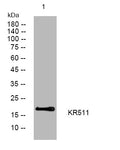 Anti-KRTAP5-11 antibody (49-99 aa) (STJ193988) – Figure 1 of 1