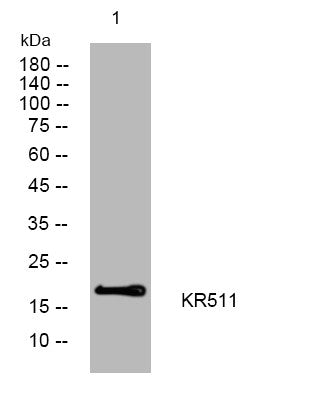 Anti-KRTAP5-11 antibody (49-99 aa) (STJ193988) – Figure 1 of 1
