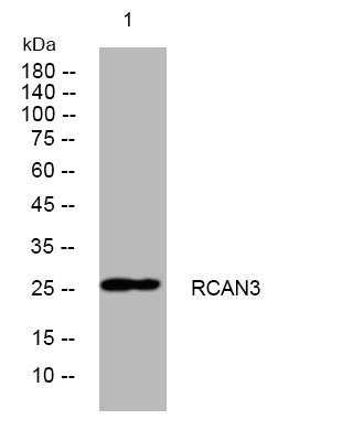 Anti-RCAN3 antibody (86-136 aa) (STJ193996) – Figure 1 of 1