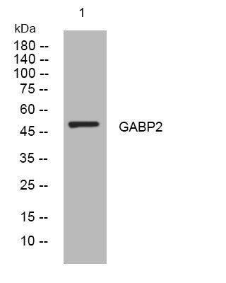 Anti-GABPB2 antibody (314-364 aa) (STJ193998) – Figure 1 of 1