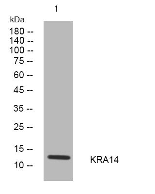 Anti-KRTAP1-4 antibody (5-55 aa) (STJ194006) – Figure 1 of 1