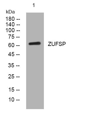 Anti-ZUP1 antibody (89-139 aa) (STJ194016) – Figure 1 of 1