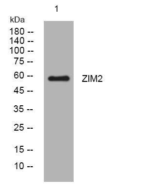 Anti-ZIM2 antibody (50-100 aa) (STJ194020) – Figure 1 of 1