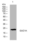 Anti-GUCA1A antibody (63-113 aa) (STJ194028) – Figure 1 of 1