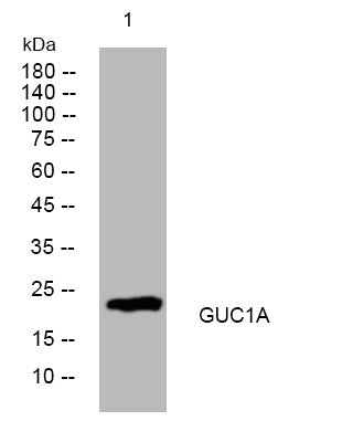 Anti-GUCA1A antibody (63-113 aa) (STJ194028) – Figure 1 of 1
