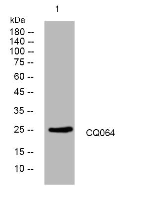 Anti-CHCT1 antibody (108-158 aa) (STJ194037) – Figure 1 of 1