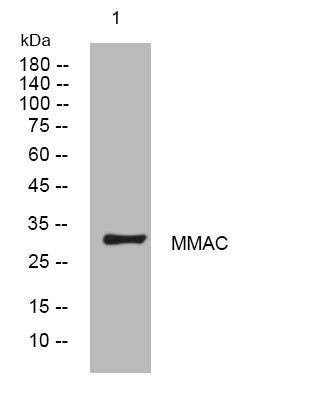 Anti-MMACHC antibody (100-150 aa) (STJ194051) – Figure 1 of 1