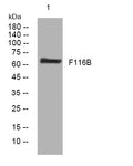 Anti-DENND6B antibody (377-427 aa) (STJ194054) – Figure 1 of 1