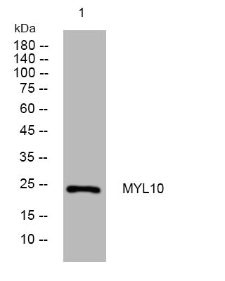 Anti-MYL10 antibody (78-128 aa) (STJ194074) – Figure 1 of 1