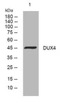Anti-DUX4 antibody (235-285 aa) (STJ194075) – Figure 1 of 1