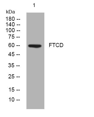 Anti-FTCD antibody (157-207 aa) (STJ194079) – Figure 1 of 1