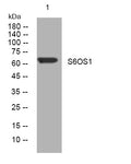 Anti-SIX6OS1 antibody (511-561 aa) (STJ194081) – Figure 1 of 1