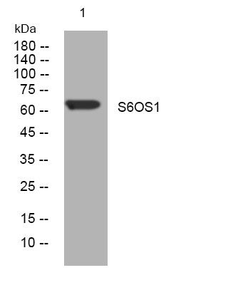 Anti-SIX6OS1 antibody (511-561 aa) (STJ194081) – Figure 1 of 1