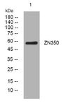 Anti-ZNF350 antibody (346-396 aa) (STJ194089) – Figure 1 of 1