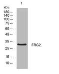 Anti-FRG2 antibody (104-154 aa) (STJ194095) – Figure 1 of 1