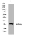 Anti-C11orf68 antibody (151-201 aa) (STJ194102) – Figure 1 of 1