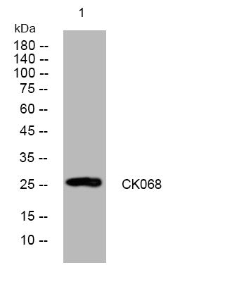 Anti-C11orf68 antibody (151-201 aa) (STJ194102) – Figure 1 of 1