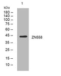 Anti-ZNF558 antibody (230-280 aa) (STJ194122) – Figure 1 of 1
