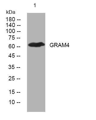 Anti-GRAMD4 antibody (304-354 aa) (STJ194133) – Figure 1 of 1