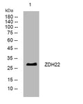 Anti-ZDHHC22 antibody (21-71 aa) (STJ194165) – Figure 1 of 1