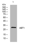 Anti-ABT1 antibody (140-190 aa) (STJ194210) – Figure 1 of 1