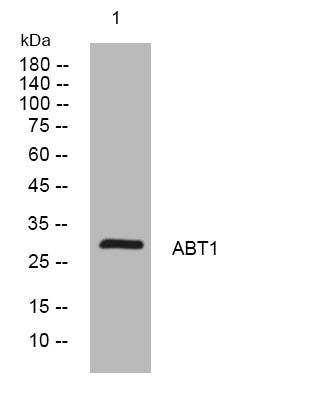 Anti-ABT1 antibody (140-190 aa) (STJ194210) – Figure 1 of 1
