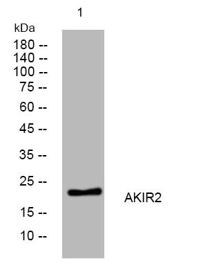 Anti-AKIRIN2 antibody (14-64 aa) (STJ194211) – Figure 1 of 1