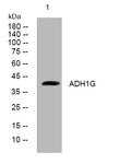 Anti-ADH1C antibody (185-235 aa) (STJ194225) – Figure 1 of 1