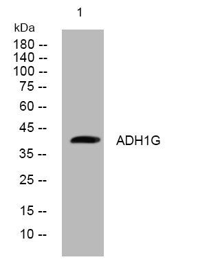 Anti-ADH1C antibody (185-235 aa) (STJ194225) – Figure 1 of 1