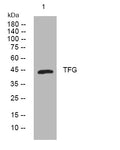 Anti-TFG antibody (127-177 aa) (STJ194230) – Figure 1 of 1