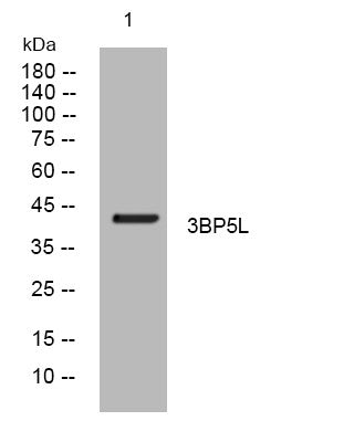 Anti-SH3BP5L antibody (87-137 aa) (STJ194268) – Figure 1 of 1