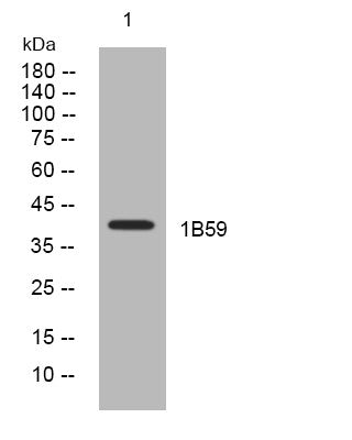 Anti-HLA-B antibody (82-132 aa) (STJ194270) – Figure 1 of 1