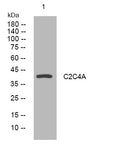 Anti-C2CD4A antibody (209-259 aa) (STJ194287) – Figure 1 of 1