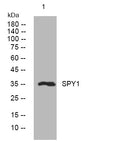 Anti-SPRY1 antibody (129-179 aa) (STJ194291) – Figure 1 of 1