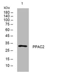 Anti-PLPP6 antibody (145-195 aa) (STJ194296) – Figure 1 of 1
