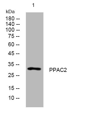 Anti-PLPP6 antibody (145-195 aa) (STJ194296) – Figure 1 of 1