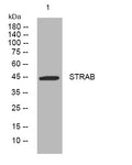 Anti-STRADB antibody (313-363 aa) (STJ194305) – Figure 1 of 1